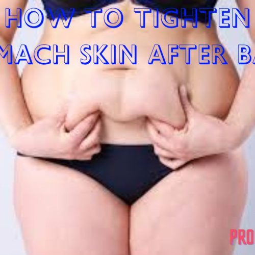 How To Tighten Stomach Skin After Baby? (12 Best Ways)